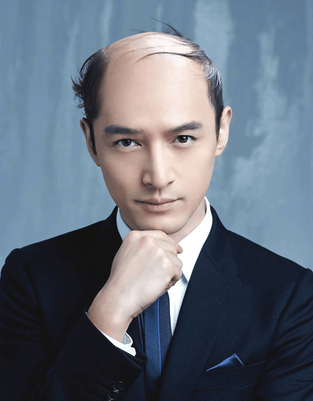 脱发的男明星,脱发的男明星，一位时代标志的沉浮录