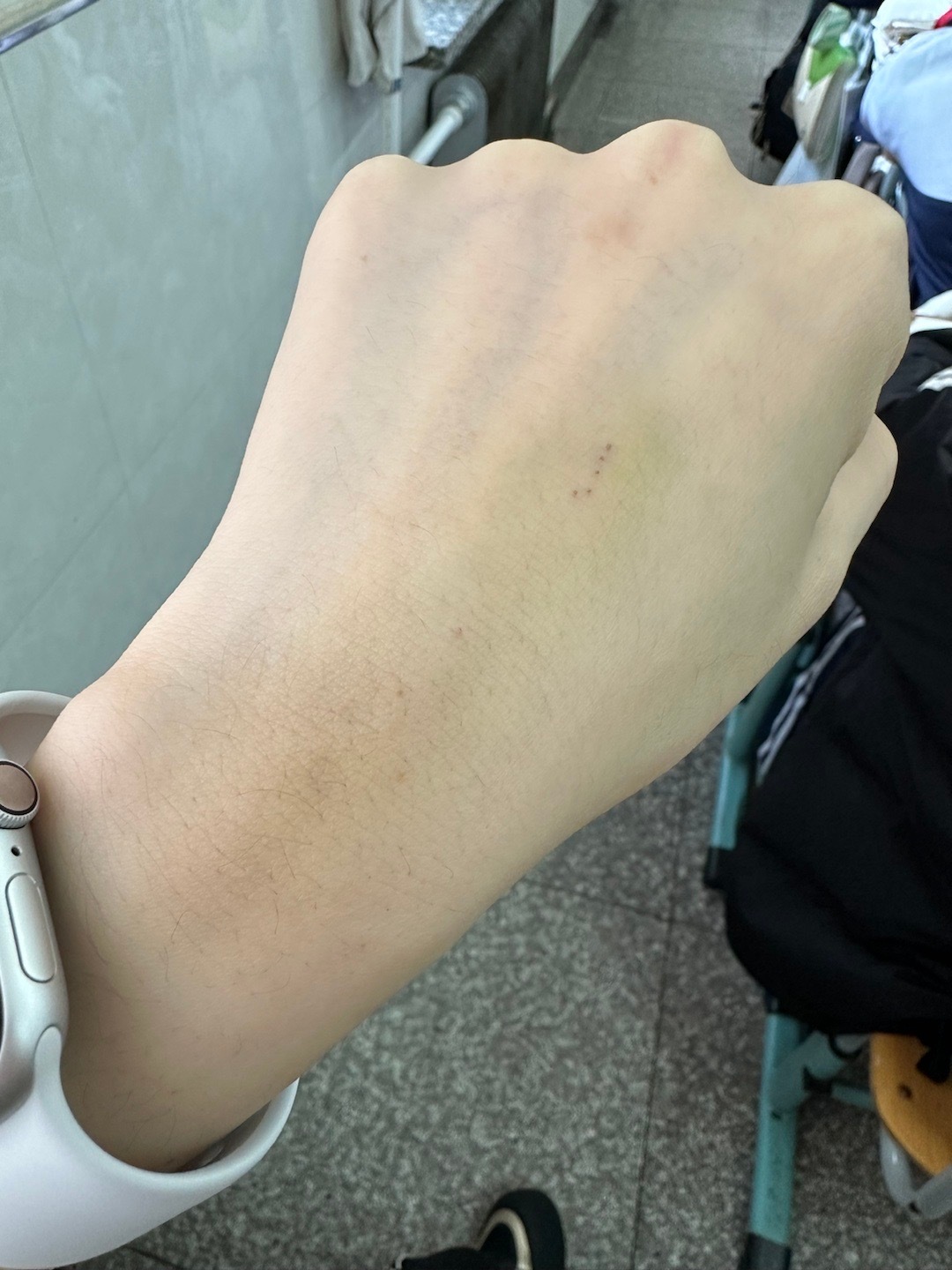从恐惧到接受，我的最新同好打针经历全记录