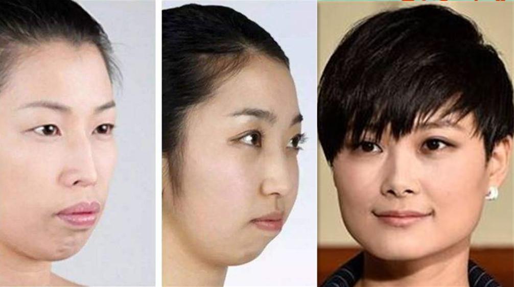 下巴短的女明星的友情与陪伴的温馨日常